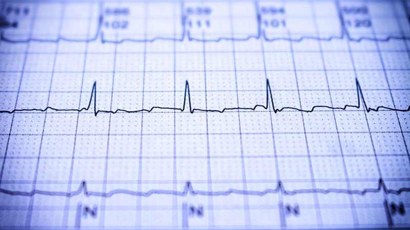 Honing Catheter Ablation Techniques for Atrial Fibrillation