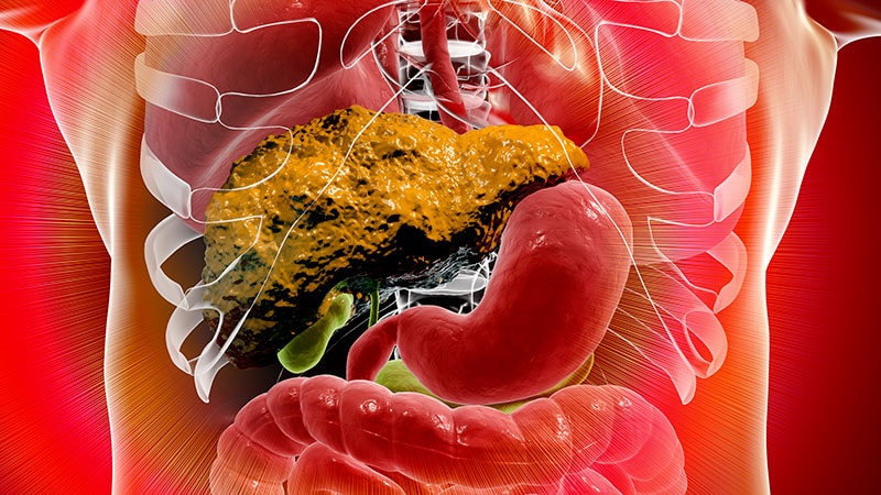 ED Visits and Mortality in Patients With Cirrhosis