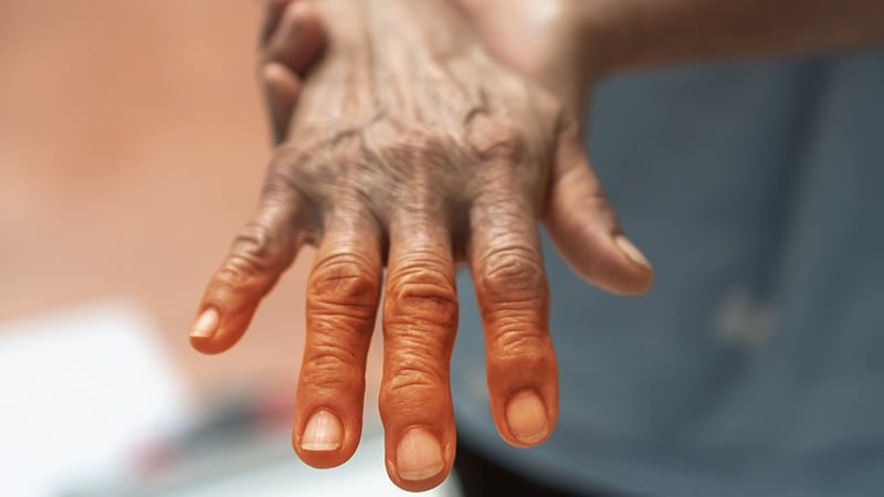 New Clinical Guidance for Sjögren-Related Neuropathy