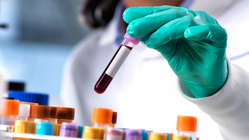 Blood Test a 'Game Changer' for Faster Stroke Diagnosis, Tx