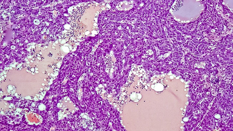 How to Manage Unresectable HCC With Liver Dysfunction