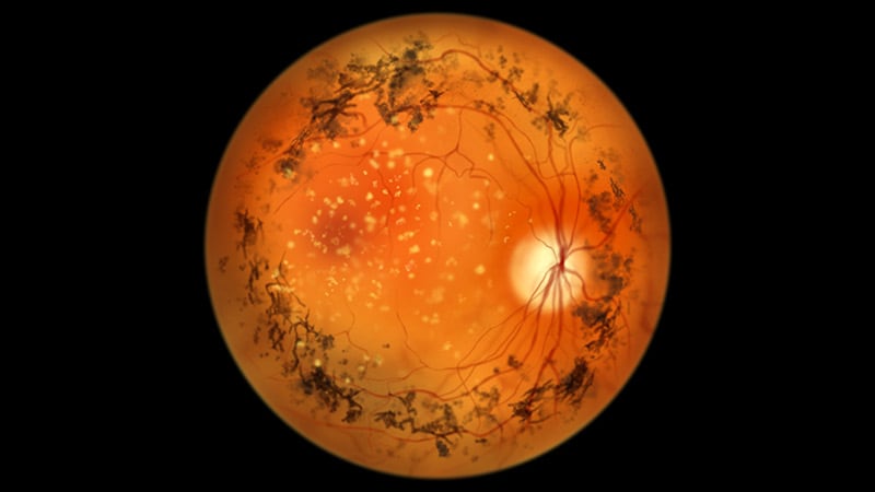 Novel Gene Therapy Safe for Retinitis Pigmentosa