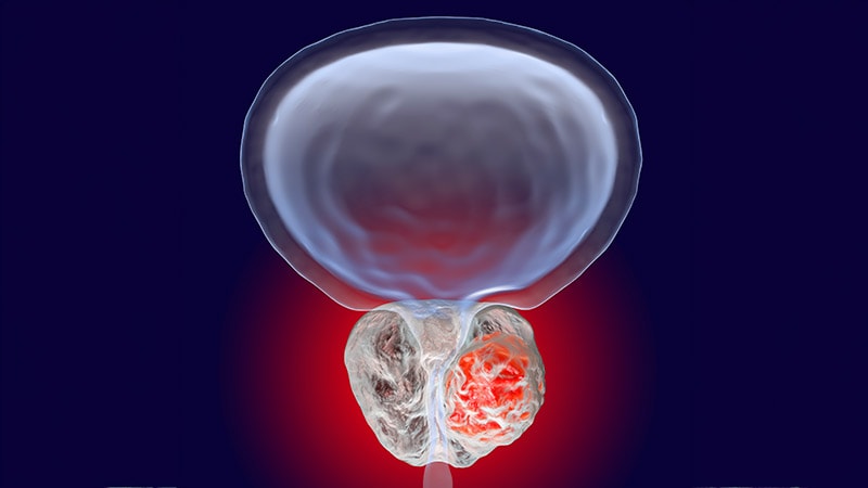 Baseline Bone Pain Predicts Survival in Mets Prostate Cancer