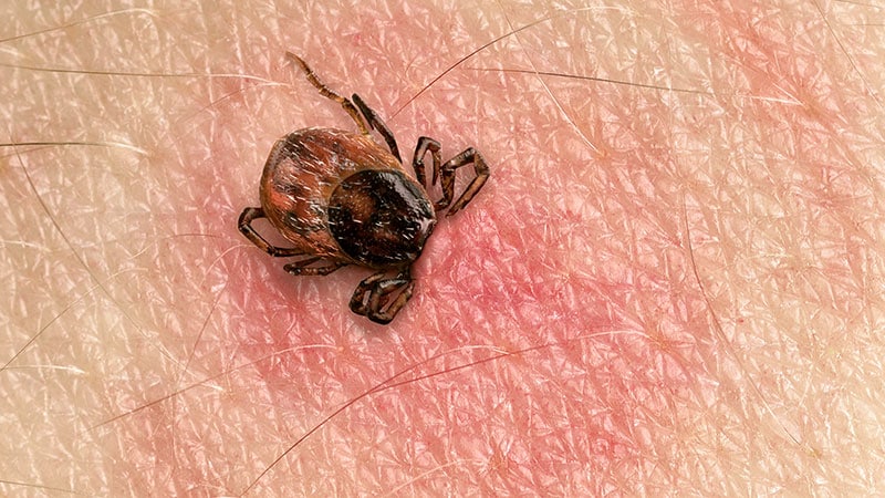 'Doesn't Fit Anything I Trained for': Treating Chronic Lyme