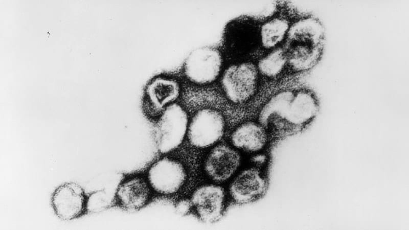 Evidence Accumulating on Viral Cause of Cutaneous Granulomas